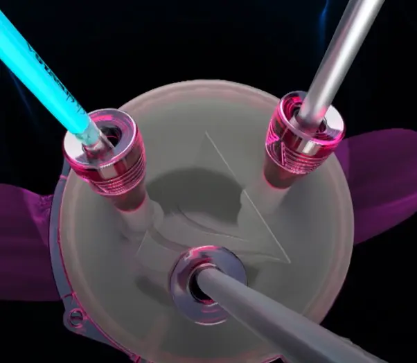 Best Gynecologist and Laparoscopic Surgeon in Shaikpet, Hyderabad