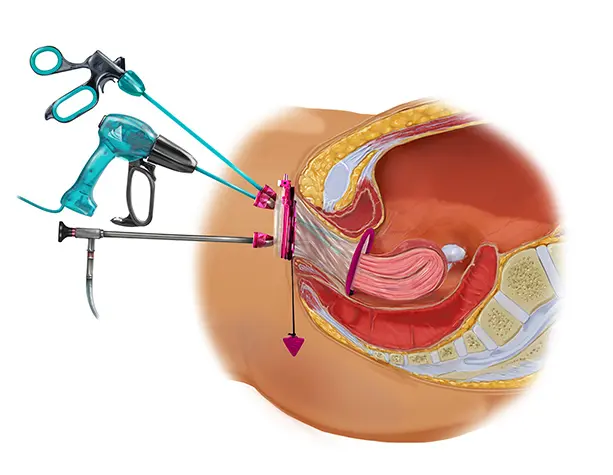 Best Gynecologist and Laparoscopic Surgeon in Shaikpet, Hyderabad