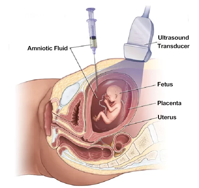 High-Risk Obstetric Situations