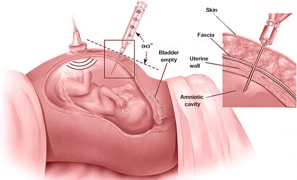 High-Risk Obstetric Situations