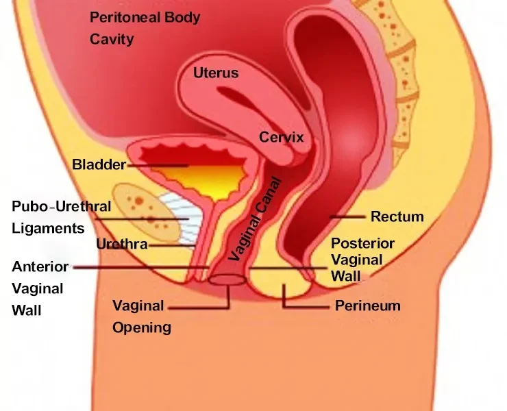 Incontinence Surgery