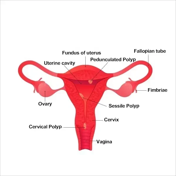 Best Gynecologist and Laparoscopic Surgeon in Shaikpet, Hyderabad